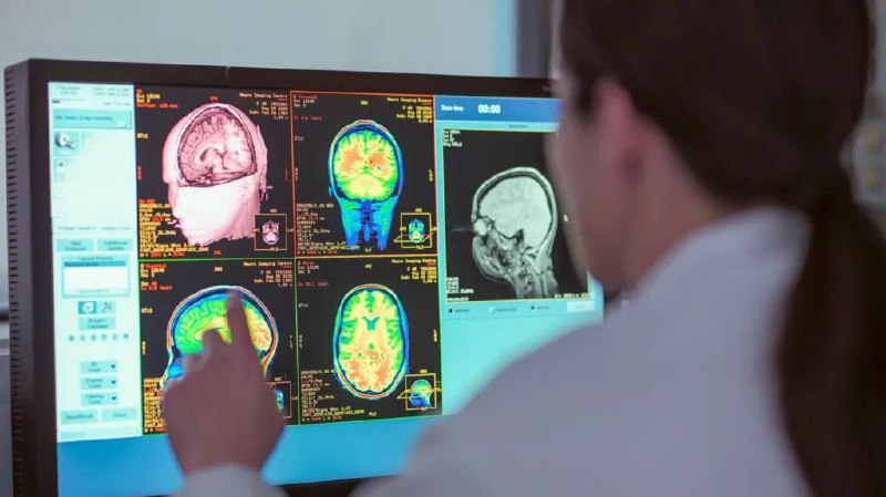 Підлітковий вік триває до 32 років, – дослідження Вчені проаналізували понад 4 т...