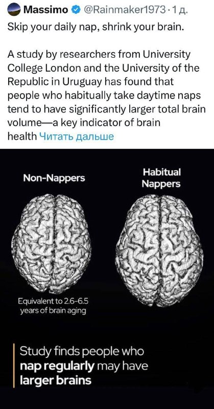 Регулярний денний сон уповільнює старіння мозку та підвищує продуктивність, — до...