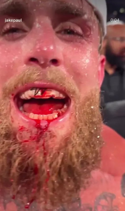 Ентоні Джошуа зламав щелепу блогеру Джейку Полу під час поєдинкуУпродовж бою зі...