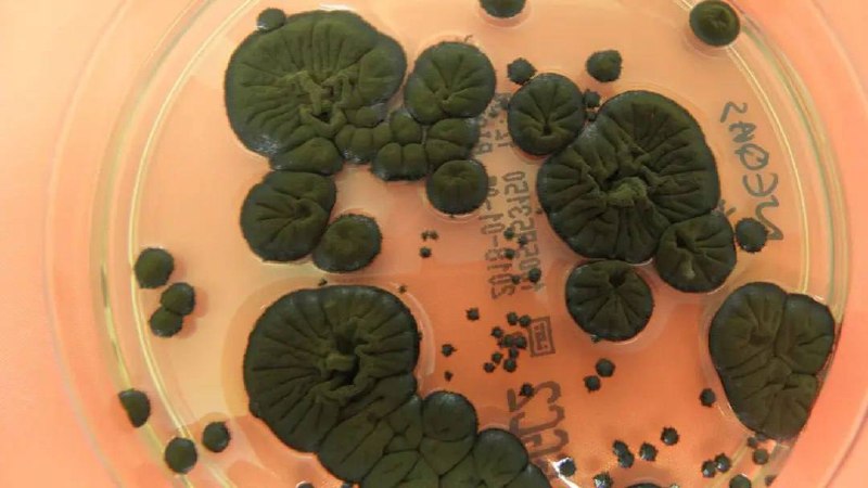 На ЧАЕС знайшли грибок, який використовує радіацію як енергію. Це може допомогти...