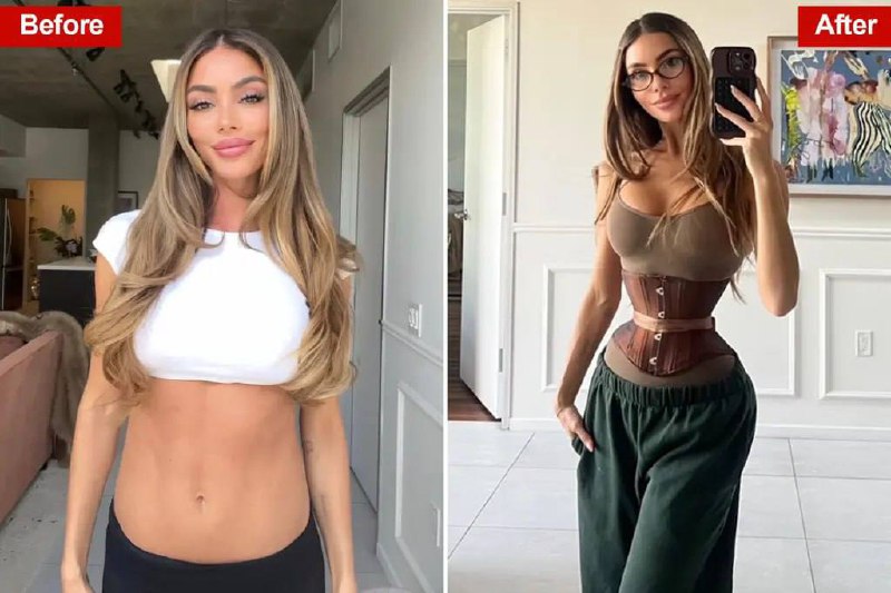 У всьому світі дівчата почали масово видаляти собі ребра заради «ідеальної» талі...