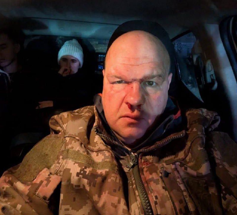 Кричущий інцидент на Тернопільщині: пʼяні молодики на квадрациклах протаранили а...